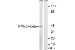 Western blot analysis of extracts from 293 cells, using p70 S6 Kinase β (Ab-423) antibody. (RPS6KB2 anticorps  (Ser423))