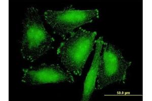 Immunofluorescence of purified MaxPab antibody to SORBS2 on HepG2 cell.