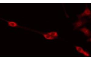 ABIN6275368 staining Hela by IF/ICC. (PABPC5 anticorps  (Internal Region))