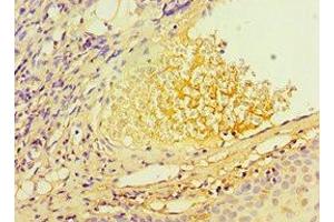 Immunohistochemistry of paraffin-embedded human blood plasma tissue using ABIN7171737 at dilution of 1:100