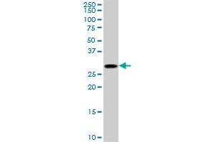 TGIF2 monoclonal antibody (M02), clone 5B11. (TGIF2 anticorps  (AA 131-236))