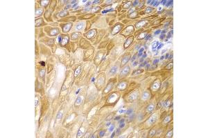 Immunohistochemistry of paraffin-embedded human esophagus using Cyclin D1 antibody (ABIN6127677, ABIN6138079, ABIN6138081 and ABIN6213800) at dilution of 1:100 (40x lens). (Cyclin D1 anticorps  (AA 96-295))