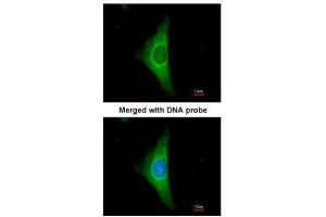 ICC/IF Image Immunofluorescence analysis of paraformaldehyde-fixed HeLa, using Cytokeratin 20, antibody at 1:200 dilution. (KRT20 anticorps)