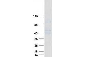 Validation with Western Blot