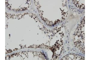 Immunoperoxidase of monoclonal antibody to PBK on formalin-fixed paraffin-embedded human testis.