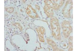 Immunohistochemistry of paraffin-embedded human kidney tissue using ABIN7155677 at dilution of 1:100 (DLX2 anticorps  (AA 1-140))