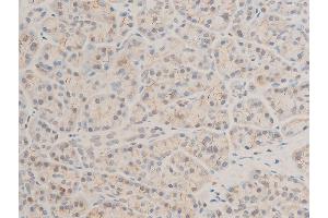 ABIN6267236 at 1/100 staining human pancreas tissue sections by IHC-P.