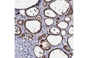 Immunohistochemical staining of human thyroid gland with ACTR6 polyclonal antibody  shows strong cytoplasmic positivity in glandular cells. (ACTR6 anticorps)