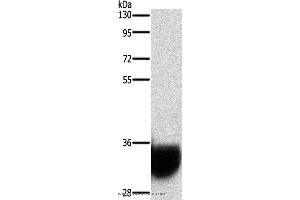 Western blot analysis of Human fetal brain tissue, using GPM6A Polyclonal Antibody at dilution of 1:1050 (GPM6A anticorps)