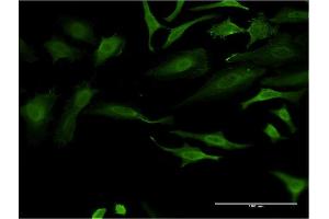 Immunofluorescence of monoclonal antibody to FOXO1 on HeLa cell.