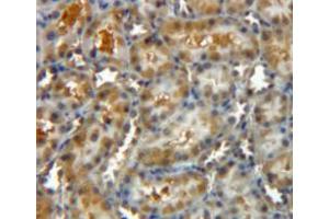Used in DAB staining on fromalin fixed paraffin-embedded kidney tissue