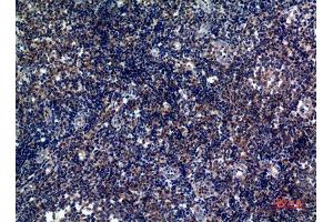 anti-Inducible T-Cell Co-Stimulator (ICOS) antibody