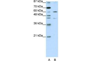 Western Blotting (WB) image for anti-Zinc Finger Protein 496 (ZNF496) antibody (ABIN2461953) (ZNF496 anticorps)