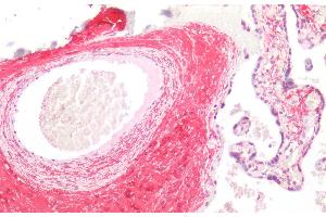 Detection of CTXI in Human Placental collagen Tissue using Monoclonal Antibody to Cross Linked C-Telopeptide Of Type I Collagen (CTXI)