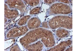 Image no. 14 for anti-Histidyl-tRNA Synthetase 2, Mitochondrial (Putative) (HARS2) antibody (ABIN1498584)