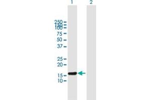 Western Blot analysis of ESCO1 expression in transfected 293T cell line by ESCO1 MaxPab polyclonal antibody.
