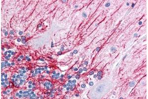 Human Brain, Cerebellum: Formalin-Fixed, Paraffin-Embedded (FFPE) (GFAP anticorps)