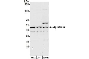 Western Blotting (WB) image for anti-Aprataxin (APTX) (AA 100-150) antibody (ABIN7452694)