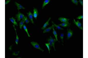 Immunofluorescence staining of Hela cells with ABIN7146245 at 1:200, counter-stained with DAPI. (Cadherin 9 anticorps  (AA 131-314))