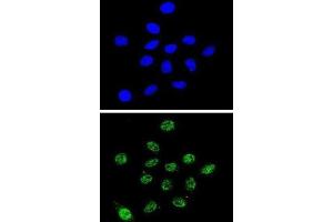 Immunofluorescence (IF) image for anti-Dyskeratosis Congenita 1, Dyskerin (DKC1) antibody (ABIN3002360) (DKC1 anticorps)