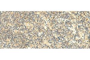 Immunohistochemistry of paraffin-embedded Human tonsil tissue using HMBOX1 Polyclonal Antibody at dilution of 1:50(x200)