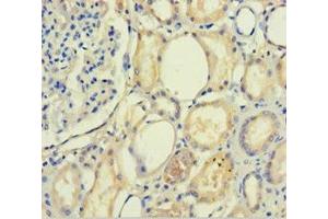 Immunohistochemistry of paraffin-embedded human kidney tissue using ABIN7168739 at dilution of 1:100 (PLA2R1 anticorps  (AA 395-530))