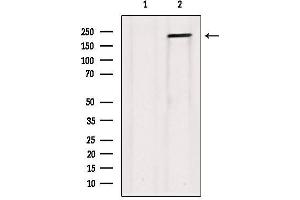 Western blot analysis of extracts from Hela, using Collagen V α1 Antibody. (COL5A1 anticorps  (Internal Region))
