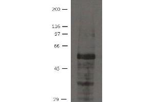 Image no. 1 for anti-Ajuba LIM Protein (AJUBA) antibody (ABIN1169674) (AJUBA anticorps)