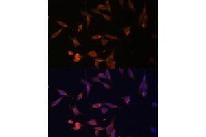 Immunofluorescence analysis of NIH-3T3 cells using UMPS Polyclonal Antibody (ABIN6128901, ABIN6149927, ABIN6149929 and ABIN6217183) at dilution of 1:100 (40x lens).