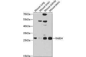Western blot analysis of extracts of various cell lines, using R antibody (ABIN6133004, ABIN6146574, ABIN6146575 and ABIN6214549) at 1:1000 dilution. (RAB34 anticorps  (AA 1-259))