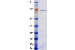 Validation with Western Blot