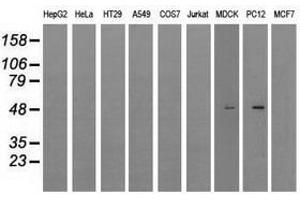 Image no. 6 for anti-Lysyl Oxidase (LOX) (AA 22-168) antibody (ABIN1491218)