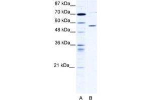 Western Blotting (WB) image for anti-Chaperonin Containing TCP1, Subunit 4 (Delta) (CCT4) antibody (ABIN2460902) (CCT4 anticorps)
