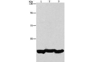 Western Blot analysis of A549 cell and Mouse liver tissue, hepG2 cell using PGK1 Polyclonal Antibody at dilution of 1:1000 (PGK1 anticorps)