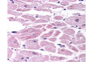 Image no. 4 for anti-Endothelial PAS Domain Protein 1 (EPAS1) (C-Term) antibody (ABIN363383)