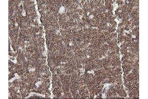 anti-Differentially Expressed in FDCP 6 Homolog (DEF6) antibody