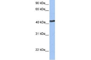WB Suggested Anti-TMEM149 Antibody Titration:  0. (IGF-like family receptor 1 (IGFLR1) (N-Term) anticorps)