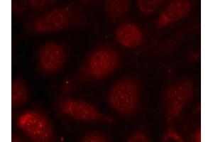 Immunofluorescence staining of methanol-fixed MCF7 cells using PKCb(phospho-Thr641) antibody.