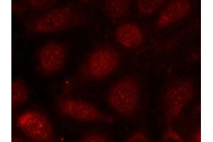 Immunofluorescence staining of methanol-fixed MCF7 cells using PKCb(phospho-Thr641) antibody. (PKC beta anticorps  (pThr641))