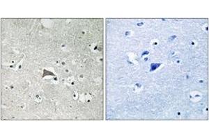 Immunohistochemistry analysis of paraffin-embedded human brain tissue, using VEGFR1 (Ab-1048) Antibody. (FLT1 anticorps  (AA 1016-1065))