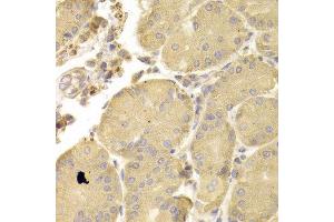 Immunohistochemistry of paraffin-embedded Human gastric using ATG7 antibody at dilution of 1:100 (x400 lens).