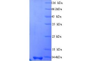 KP6T (AA 28-105) protein (His tag)