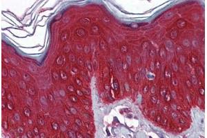 Human Skin: Formalin-Fixed, Paraffin-Embedded (FFPE)