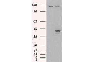 Image no. 2 for anti-E74-Like Factor 3 (Ets Domain Transcription Factor, Epithelial-Specific) (ELF3) (C-Term) antibody (ABIN374234) (ELF3 anticorps  (C-Term))