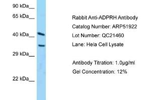 Western Blotting (WB) image for anti-ADP-Ribosylarginine Hydrolase (ADPRH) (C-Term) antibody (ABIN2784688)