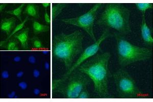 ABIN1590007 Immunofluorescence analysis of paraformaldehyde fixed HeLa cells, permeabilized with 0. (Patched 1 anticorps  (AA 266-280))