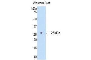 Western Blotting (WB) image for anti-Lymphocyte Antigen 9 (CD229) (AA 2-212) antibody (ABIN1174910) (LY9 anticorps  (AA 2-212))