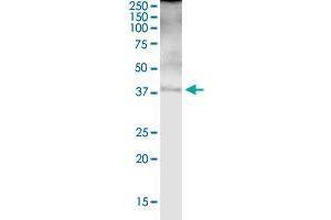 FBP1 MaxPab rabbit polyclonal antibody. (FBP1 anticorps  (AA 1-338))