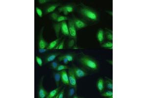 Immunofluorescence analysis of U-2 OS cells using VCP antibody (ABIN6128632, ABIN6150072, ABIN6150073 and ABIN6217335) at dilution of 1:100.