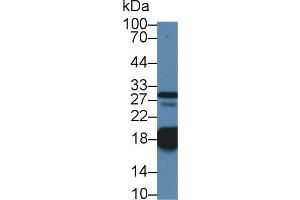 Western blot analysis of Pig Heart lysate, using Human TNNC1 Antibody (1 µg/ml) and HRP-conjugated Goat Anti-Rabbit antibody ( (TNNC1 anticorps  (AA 1-161))